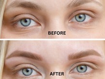 Face Surgery 