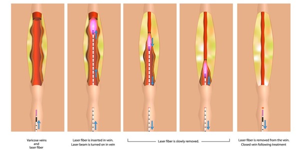 Interventional Radiology