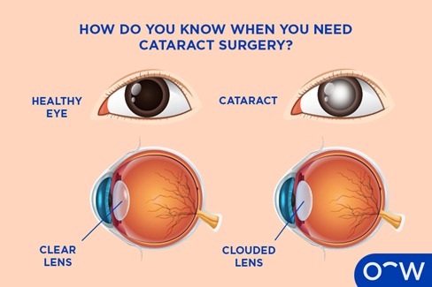Eye Sight