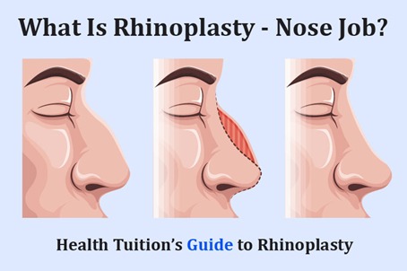 Rhinoplasty