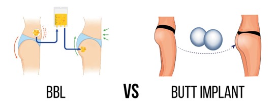 Body Surgery